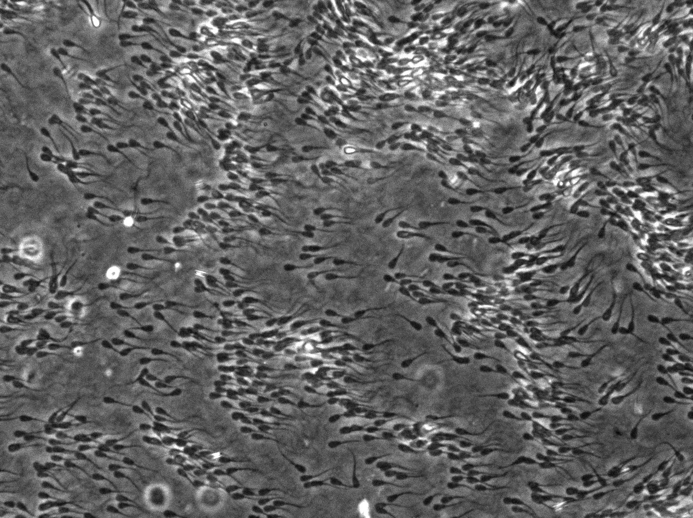 A scientific image of flocking sperm cells